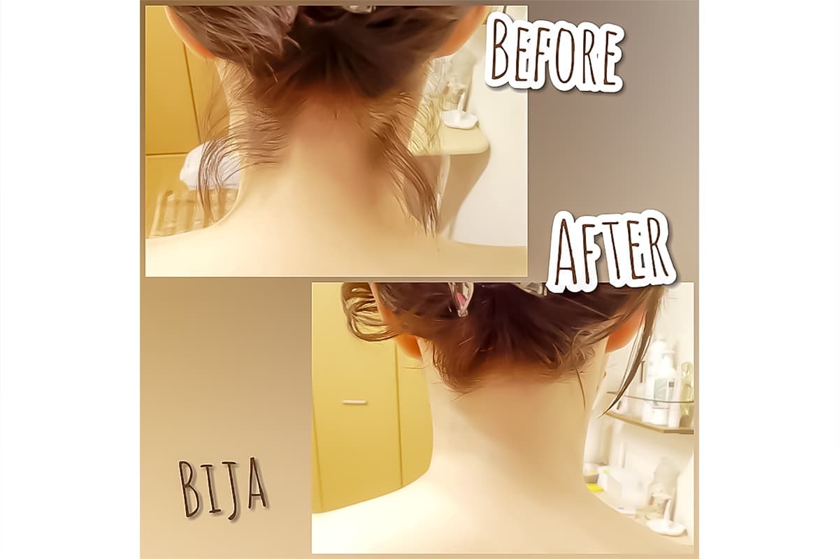 脱毛&BeautySalon Bija 5