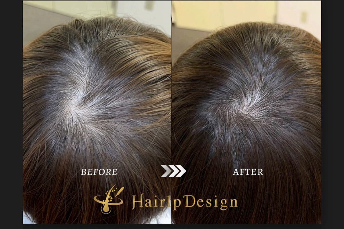 薄毛を改善!! Scalp Design HAIR TATTOO 甲府昭和店 【休業】 4