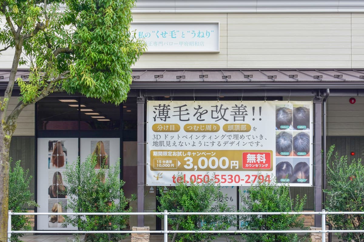 薄毛を改善!! Scalp Design HAIR TATTOO 甲府昭和店 【休業】 1