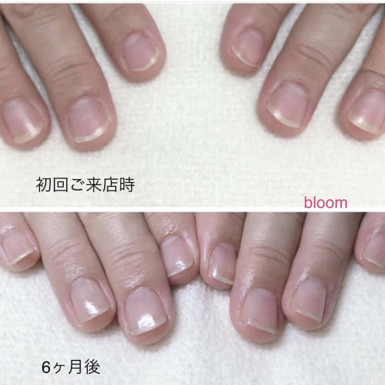 美爪を育てるために大切なこと